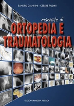 Manuale Di Ortopedia E Traumatologia fronte