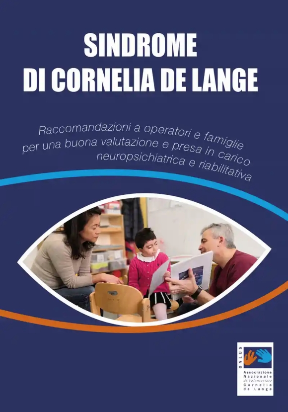 Sindrome Di Cornelia De Lange